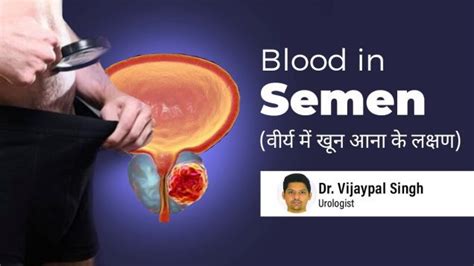 pink semen|Blood In Semen (Hematospermia): Causes & Treatment.